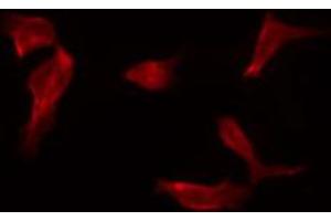 ABIN6267230 staining HepG2 by IF/ICC. (IKK-alpha /IKK-beta 抗体  (pSer180, pSer181))