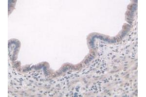IHC-P analysis of Mouse Uterus Tissue, with DAB staining. (ADAMTS7 抗体  (AA 226-437))