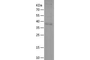 CD14 (CD14) (AA 20-171) protein (His-IF2DI Tag)