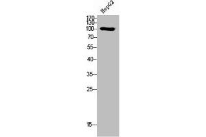 Western Blot analysis of HepG2 cells using PI 3-Kinase p110δ Polyclonal Antibody (PIK3CD 抗体  (N-Term))