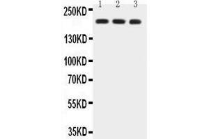 Anti-BRCA1 Picoband antibody,  All lanes: Anti-BRCA1 at 0. (BRCA1 抗体  (AA 1661-1863))