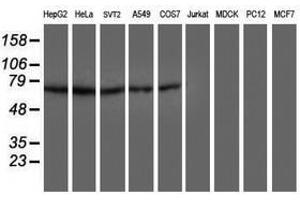 Image no. 2 for anti-Dystrobrevin, beta (DTNB) antibody (ABIN1497917) (Dystrobrevin beta 抗体)