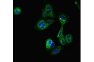 Immunofluorescent analysis of Hela cells using ABIN7149055 at dilution of 1:100 and Alexa Fluor 488-congugated AffiniPure Goat Anti-Rabbit IgG(H+L) (CRIP2 抗体  (AA 1-208))