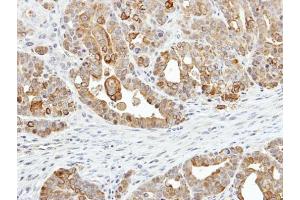 IHC-P Image Immunohistochemical analysis of paraffin-embedded NCI-N87 xenograft, using ZER1, antibody at 1:500 dilution. (ZER1 抗体  (C-Term))