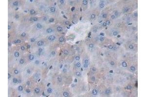 Immunohistochemistry (IHC) image for anti-Mitogen-Activated Protein Kinase 8 (MAPK8) (AA 138-370) antibody (ABIN7439327)