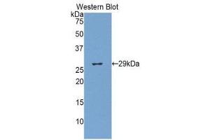 Western Blotting (WB) image for anti-Glucuronidase, beta (GUSB) (AA 440-648) antibody (ABIN1859102)