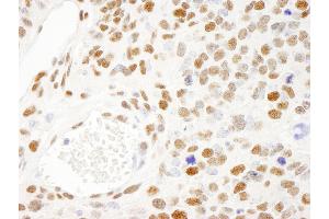 Immunohistochemistry (IHC) image for anti-KH-Type Splicing Regulatory Protein (KHSRP) (AA 100-150) antibody (ABIN7448625)