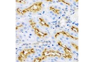 Immunohistochemical analysis of Aminoacylase 1 staining in rat kidney formalin fixed paraffin embedded tissue section. (Aminoacylase 1 抗体)