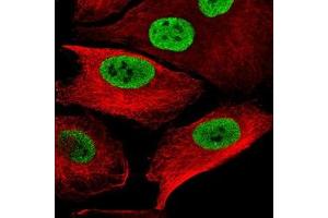Immunofluorescence staining of WM-115 cell with antibody shows specific staining in the nucleoplasm in green. (SOX10 抗体)