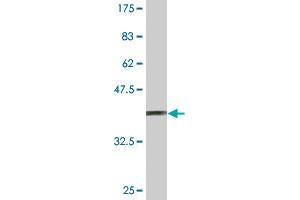 Western Blot detection against Immunogen (37. (SUPT5H 抗体  (AA 981-1087))