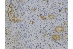 Immunohistochemistry (IHC) image for anti-Complement Component 1, Q Subcomponent, B Chain (C1QB) (Internal Region) antibody (ABIN6260363)