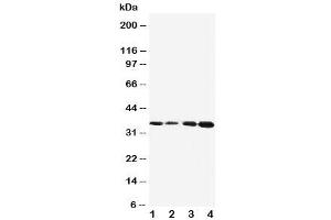 Western blot testing of Protein C antibody and Lane 1:  Jurkat (PROC 抗体  (AA 446-461))