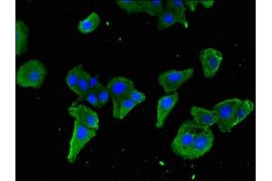 Immunofluorescence (IF) image for anti-Signal Transducer and Activator of Transcription 5B (STAT5B) (AA 40-280) antibody (ABIN7169686)