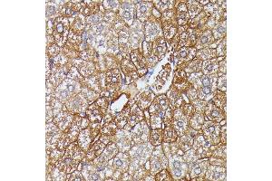 Immunohistochemistry of paraffin-embedded mouse liver using HDLBP antibody (ABIN6128051, ABIN6141701, ABIN6141702 and ABIN6221672) at dilution of 1:100 (40x lens). (HDLBP 抗体  (AA 1035-1268))