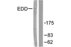 Western blot analysis of extracts from A549 cells, using EDD Antibody.