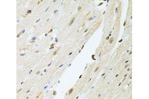 Immunohistochemistry of paraffin-embedded Mouse heart using PNKP Polyclonal Antibody at dilution of 1:100 (40x lens).