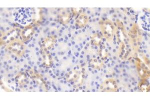 Immunohistochemistry (IHC) image for anti-beta-Site APP-Cleaving Enzyme 2 (BACE2) (AA 230-396) antibody (ABIN7434101)
