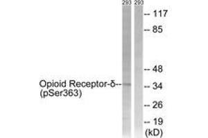 Western blot analysis of extracts from 293 cells treated with TSA 400nM 24h, using Opioid Receptor-delta (Phospho-Ser363) Antibody. (OPRD1 抗体  (pSer363))