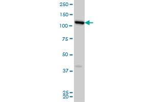 Western Blotting (WB) image for anti-Coiled-Coil Domain Containing 132 (CCDC132) (AA 862-965) antibody (ABIN961368) (Syndetin/VPS50 抗体  (AA 862-965))