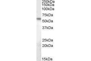 Western Blotting (WB) image for CUGBP, Elav-Like Family Member 5 (CELF5) peptide (ABIN369042) (CUGBP, Elav-Like Family Member 5 (CELF5) Peptide)