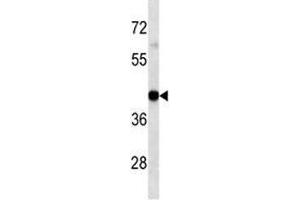 Western Blotting (WB) image for anti-Major Histocompatibility Complex, Class I, A (HLA-A) (AA 70-99) antibody (ABIN3031678)