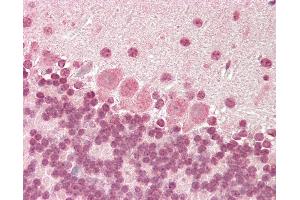 Mouse Brain, Cerebellum: Formalin-Fixed, Paraffin-Embedded (FFPE)