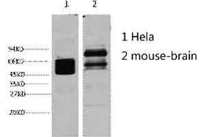 Western blot analysis of 1) Hela, 2) mouse brain, diluted at 1:4000. (KRT8 抗体)