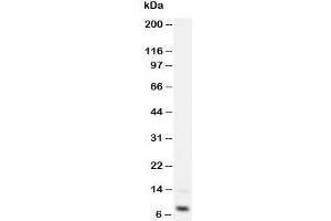 Western blot testing of IGF-1 antibody and recombinant human protein 2. (IGF1 抗体  (Middle Region))