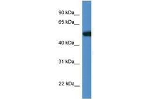 Image no. 1 for anti-Tigger Transposable Element Derived 4 (TIGD4) (AA 110-159) antibody (ABIN6746364) (TIGD4 抗体  (AA 110-159))