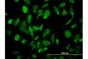 Image no. 3 for anti-Nuclear Receptor Coactivator 4 (NCOA4) (AA 505-615) antibody (ABIN599026) (NCOA4 抗体  (AA 505-615))