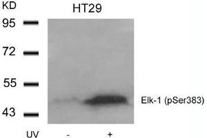 Western blot analysis of extracts from HT29 cells untreated or treated with UV using Elk-1(Phospho-Ser383) Antibody. (ELK1 抗体  (pSer383))