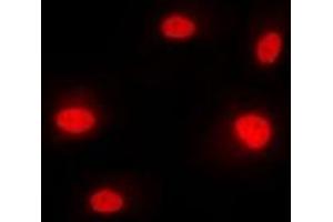 Immunofluorescent analysis of hnRNP M staining in MCF7 cells. (HNRNPM 抗体  (N-Term))