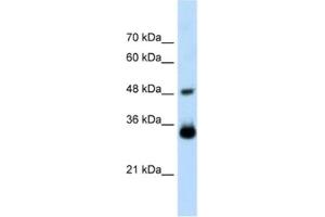 Western Blotting (WB) image for anti-Homeobox C9 (HOXC9) antibody (ABIN2461220) (HOXC9 抗体)