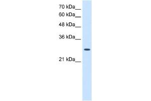 WB Suggested Anti-AK2 Antibody Titration:  2. (Adenylate Kinase 2 抗体  (N-Term))