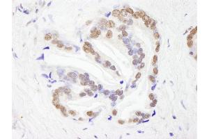 Immunohistochemistry (IHC) image for anti-RNA Binding Motif Protein 26 (RBM26) (AA 200-250) antibody (ABIN7448763) (RBM26 抗体  (AA 200-250))