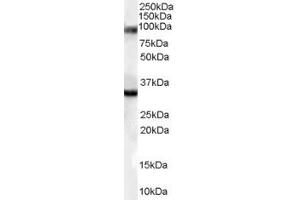 ABIN185471 (0. (LIM Domain Binding 3 Protein 抗体  (Internal Region))