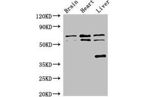 Western Blot Positive WB detected in: Mouse brain tissue, Rat heart tissue, Rat liver tissue All lanes: TRAF3IP3 antibody at 2. (TRAF3IP3 抗体  (AA 74-185))