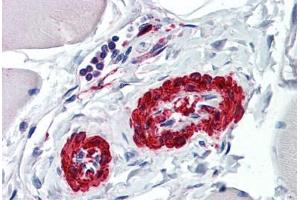 Immunohistochemistry (Formalin-fixed Paraffin-embedded Sections) (IHC (fp)) image for anti-Actin, alpha 2, Smooth Muscle, Aorta (ACTA2) (AA 1-378) antibody (ABIN790443)