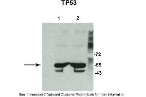 Sample Type: 1. (p53 抗体  (N-Term))