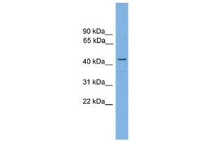 WB Suggested Anti-RDH16  Antibody Titration: 0. (RDH16 抗体  (Middle Region))