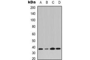 Western blot analysis of IKB alpha (pY42) expression in K562 (A), Jurkat IL1b-treated (B), Raw264. (NFKBIA 抗体  (N-Term, pTyr42))