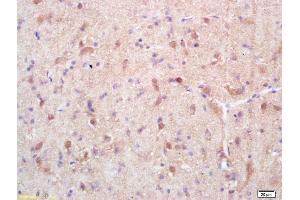 Formalin-fixed and paraffin embedded rat brain labeled with Rabbit Anti Exportin 1/CRM1 Polyclonal Antibody, Unconjugated (ABIN1714155) at 1:200 followed by conjugation to the secondary antibody and DAB staining (XPO1 抗体  (AA 701-800))