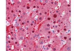 FAH antibody was used for immunohistochemistry at a concentration of 4-8 ug/ml. (FAH 抗体)