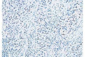 anti-RAP1 Interacting Factor Homolog (RIF1) (AA 1-50) antibody