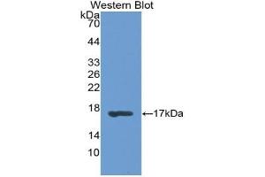 Western blot analysis of the recombinant protein. (RBP1 抗体  (AA 2-135))