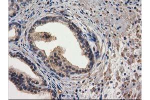 Image no. 14 for anti-Destrin (Actin Depolymerizing Factor) (DSTN) antibody (ABIN1497910) (Destrin 抗体)