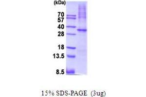 SDS-PAGE (SDS) image for Protein Kinase, AMP-Activated, alpha 1 Catalytic Subunit (PRKAA1) (AA 1-279) protein (His tag) (ABIN5854103) (PRKAA1 Protein (AA 1-279) (His tag))
