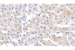 Detection of MCP2 in Bovine Liver Tissue using Polyclonal Antibody to Monocyte Chemotactic Protein 2 (MCP2) (CCL8 抗体  (AA 1-99))