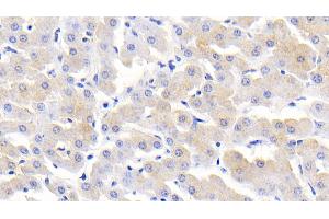 Detection of MCP2 in Bovine Liver Tissue using Polyclonal Antibody to Monocyte Chemotactic Protein 2 (MCP2)