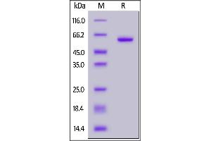 SARS-CoV-2 S protein RBD (K417N, E484K, N501Y), Fc Tag on  under reducing (R) condition.